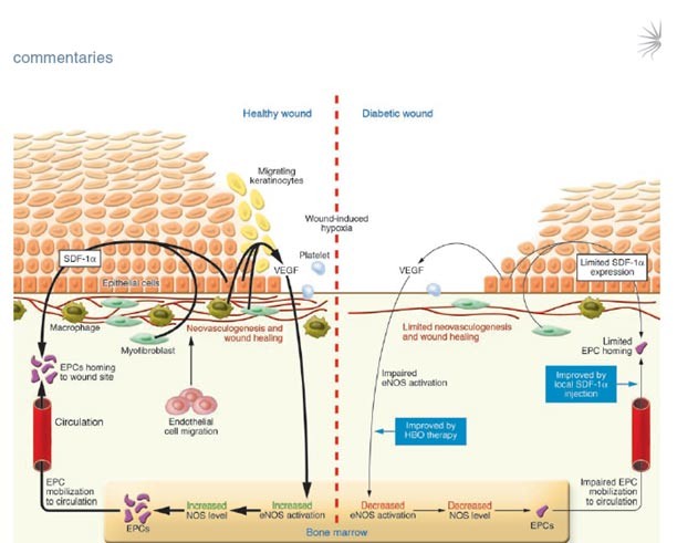 קובץ:תהליך ריפוי פצע.jpg