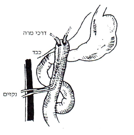 קובץ:Gallbladder208.jpg