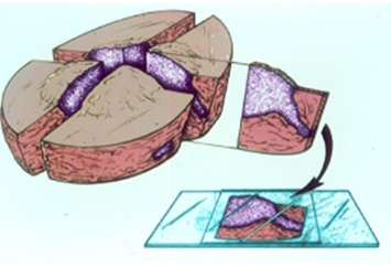 קובץ:ציור 2 - בדיקה מדגמית בשיטה העיוורת.jpg