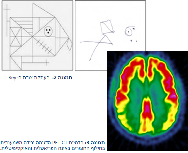 ניווןקליפתיאחורי 2 3.png