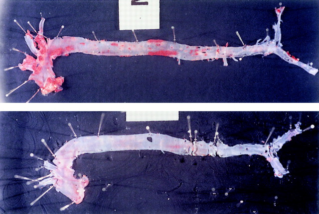 קובץ:Monocyte 2.png