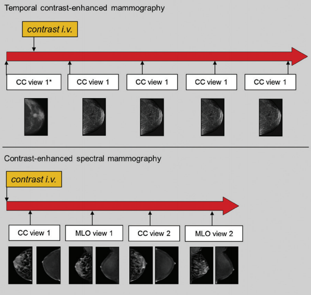 קובץ:ממוגרפיה עם ניגוד2.png