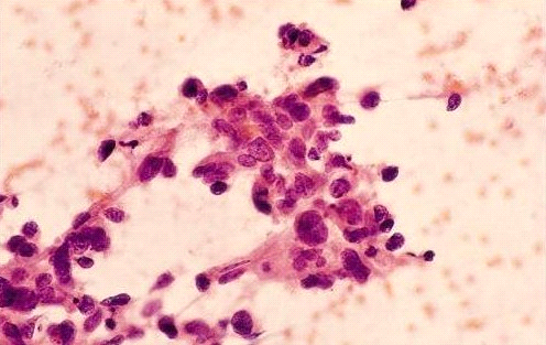 קובץ:FNA3012b.png