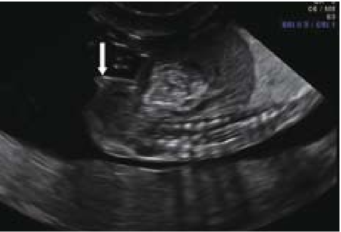 קובץ:Fetal sex2.png