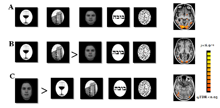 קובץ:ניווןקליפתיאחורי 4.png