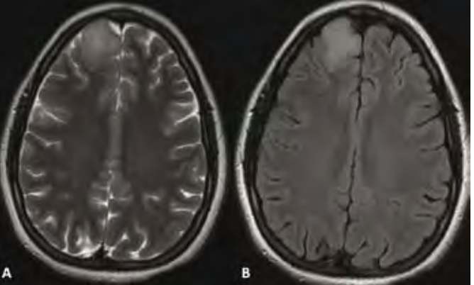 קובץ:דימות מוח2.png