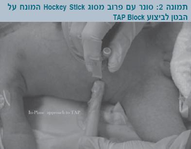 חידושיםבהרדמה2.jpg
