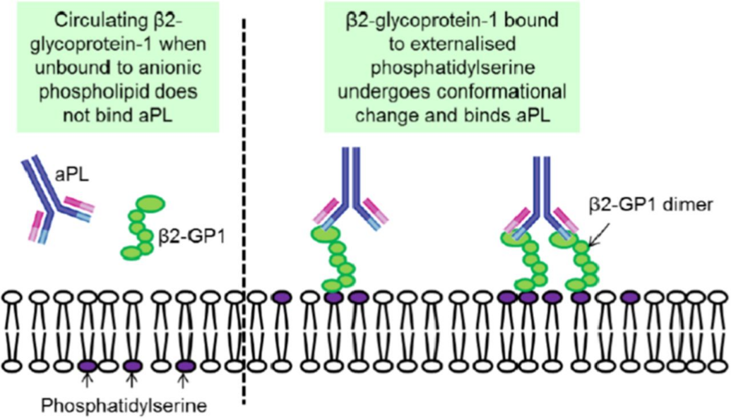 נוגדנים מסוג IgG או IgM לBeta 2 glycoprotein 1 ויקירפואה