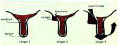 קובץ:איטומי חריצים6.png