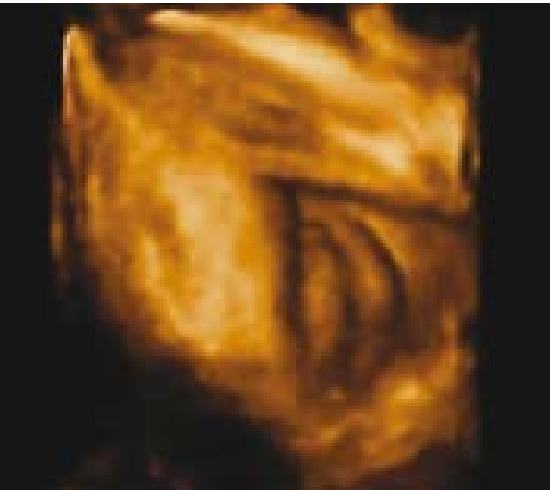 קובץ:Fetal sex13.png