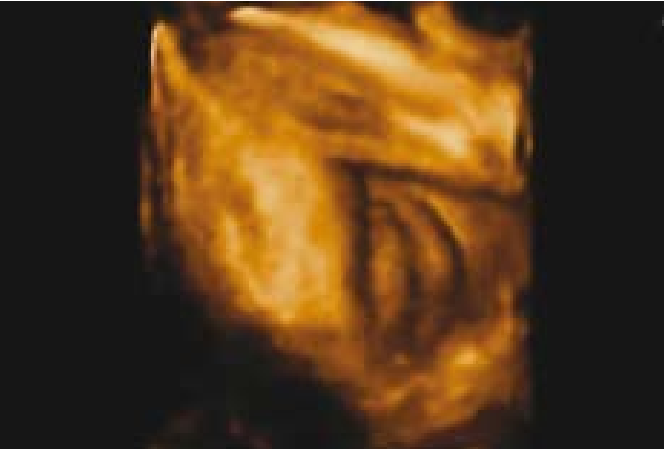 קובץ:Fetal sex10.png