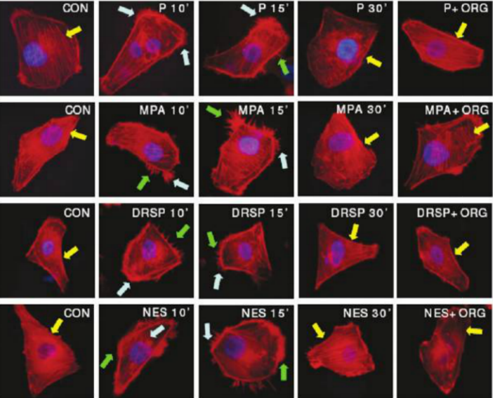 קובץ:סרטן שד 2.png