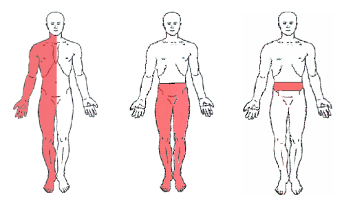 קובץ:מיקום כאב.jpg