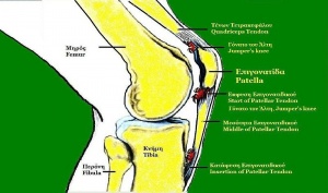 קובץ:800px-Patellar Tendonitis.jpg