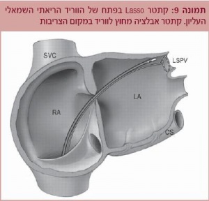 צריבה9.JPG