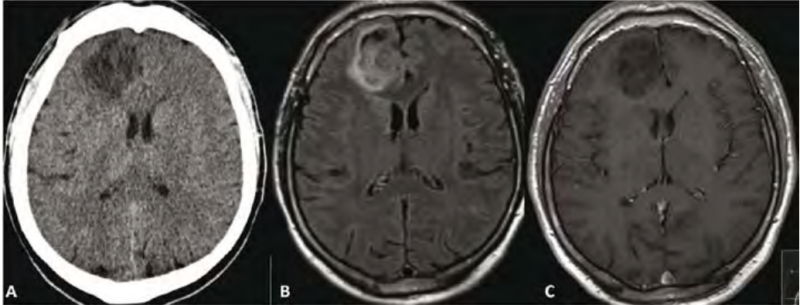קובץ:דימות מוח1.png