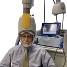 Transcranial magnetic stimulation.jpg