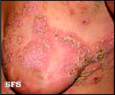 Skin conditions2.png