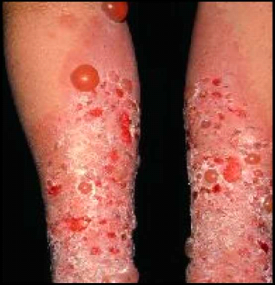 Skin conditions1.png