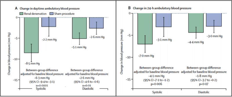 קובץ:תמונה 4. מחקר RADIANCE-HTN SOLO- שינוי לחץ דם אמבולטורי לאחר חודשיים בערות (A) וב- 24 שעות (B)..png