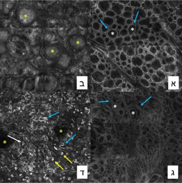 קובץ:מיקרוסקופיה קונפוקלית2.jpg