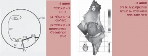 צריבה5.JPG
