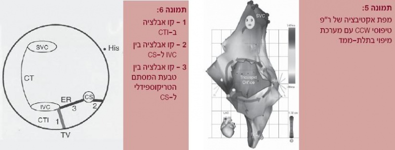 קובץ:צריבה5.JPG