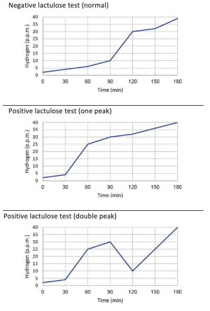 דוגמאות לפענוח תבחיני נשיפה ל- SIBO מבוססי לקטולוז.png