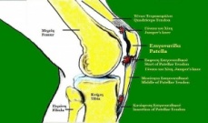 800px-Patellar Tendonitis.jpg