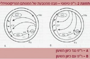 צריבה2.JPG