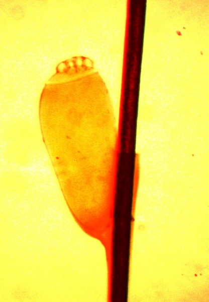 קובץ:Pediculus2.JPG